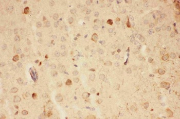 Hsp90 alpha/HSP90AA1 Rabbit Polyclonal Antibody
