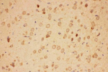 Hsp90 alpha/HSP90AA1 Rabbit Polyclonal Antibody