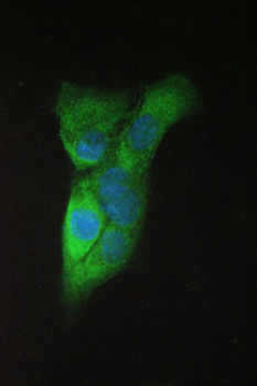 beta Amyloid/APP Rabbit Polyclonal Antibody