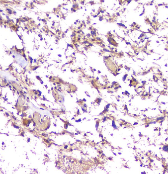 beta Amyloid/APP Rabbit Polyclonal Antibody
