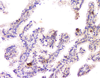 beta Amyloid/APP Rabbit Polyclonal Antibody