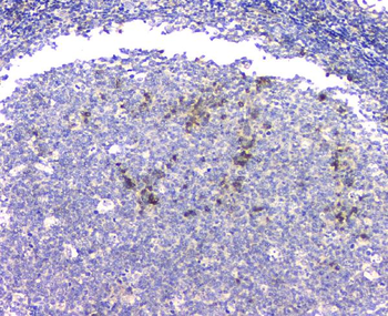 beta Amyloid/APP Rabbit Polyclonal Antibody