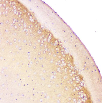 beta Amyloid/APP Rabbit Polyclonal Antibody