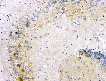 beta Amyloid/APP Rabbit Polyclonal Antibody