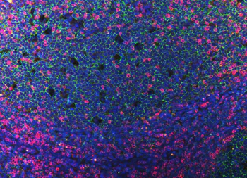 CD3 epsilon/CD3E Rabbit Polyclonal Antibody
