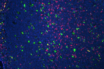 CD3 epsilon/CD3E Rabbit Polyclonal Antibody