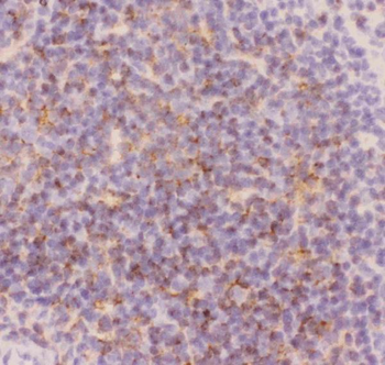 CD3 epsilon/CD3E Rabbit Polyclonal Antibody
