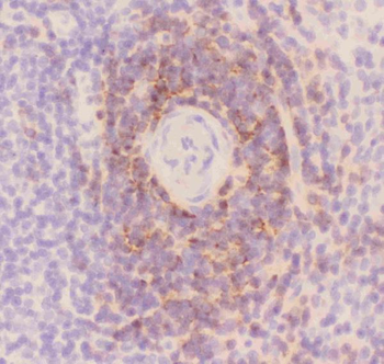 CD3 epsilon/CD3E Rabbit Polyclonal Antibody