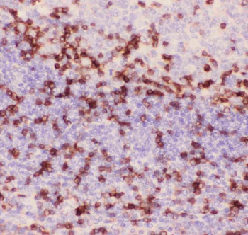 CD3 epsilon/CD3E Rabbit Polyclonal Antibody