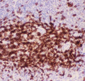 CD3 epsilon/CD3E Rabbit Polyclonal Antibody