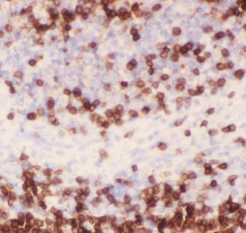 CD3 epsilon/CD3E Rabbit Polyclonal Antibody