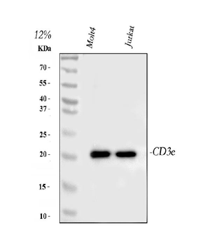 CD3 epsilon/CD3E Rabbit Polyclonal Antibody