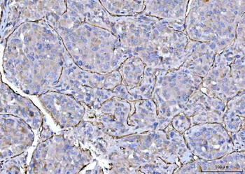 CD31/PECAM1 Rabbit Polyclonal Antibody