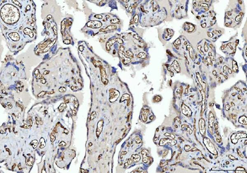 CD31/PECAM1 Rabbit Polyclonal Antibody