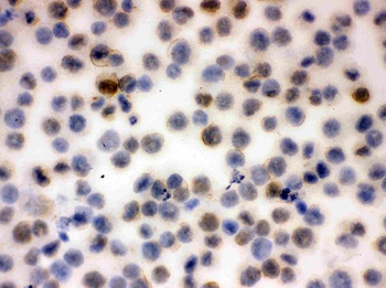 CD43/SPN Rabbit Polyclonal Antibody