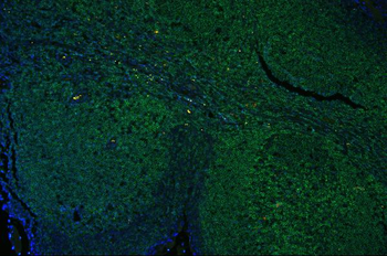 CD45/PTPRC Rabbit Polyclonal Antibody