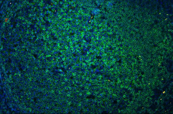 CD45/PTPRC Rabbit Polyclonal Antibody