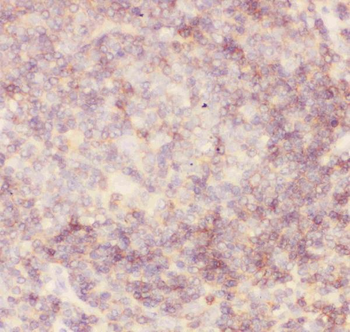 CD45/PTPRC Rabbit Polyclonal Antibody