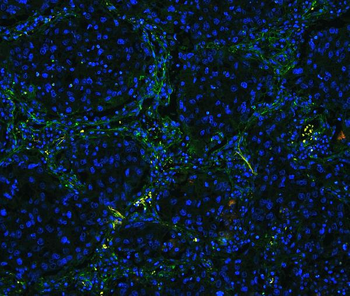 Collagen IV/COL4A1 Rabbit Polyclonal Antibody