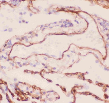 Collagen IV/COL4A1 Rabbit Polyclonal Antibody