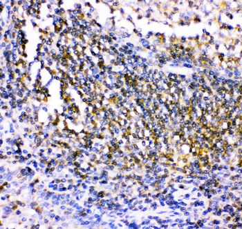 Csk Rabbit Polyclonal Antibody
