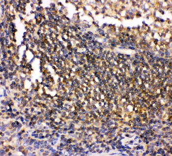 Csk Rabbit Polyclonal Antibody