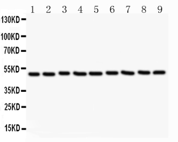 Csk Rabbit Polyclonal Antibody