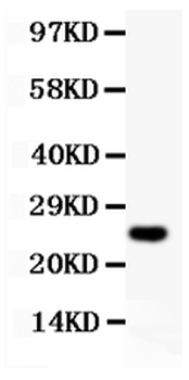 Cyclin D3/CCND3 Rabbit Polyclonal Antibody