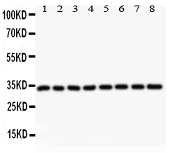 Cyclin D3/CCND3 Rabbit Polyclonal Antibody