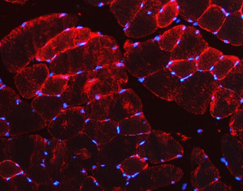 Desmin Rabbit Polyclonal Antibody