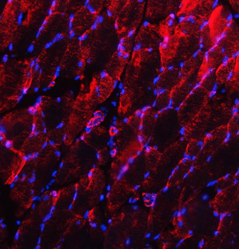 Desmin Rabbit Polyclonal Antibody