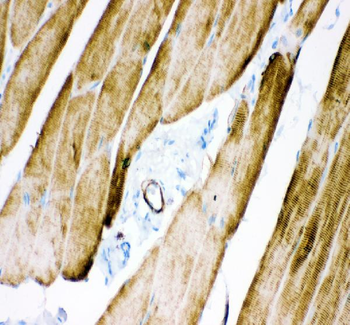 Desmin Rabbit Polyclonal Antibody