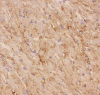 Glucose Transporter GLUT4/SLC2A4 Rabbit Polyclonal Antibody