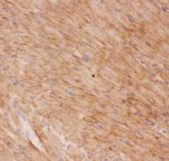 Glucose Transporter GLUT4/SLC2A4 Rabbit Polyclonal Antibody