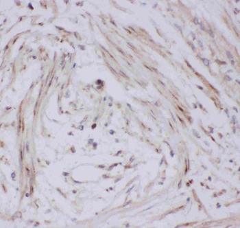 Glucose Transporter GLUT4/SLC2A4 Rabbit Polyclonal Antibody