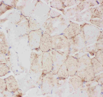Glucose Transporter GLUT4/SLC2A4 Rabbit Polyclonal Antibody