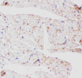 Glucose Transporter GLUT4/SLC2A4 Rabbit Polyclonal Antibody
