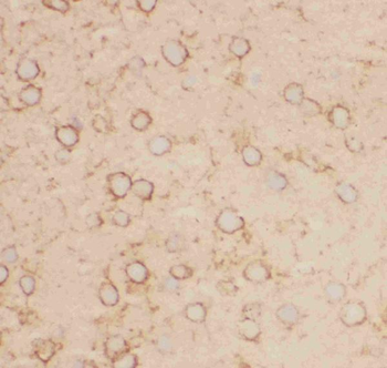 Kv2.1/KCNB1 Rabbit Polyclonal Antibody