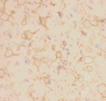 Kv2.1/KCNB1 Rabbit Polyclonal Antibody