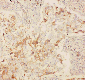 Kv2.1/KCNB1 Rabbit Polyclonal Antibody