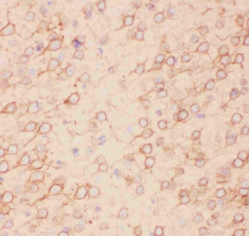 Kv2.1/KCNB1 Rabbit Polyclonal Antibody