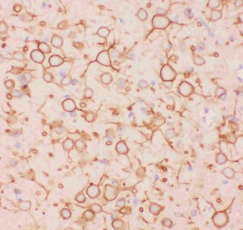 Kv2.1/KCNB1 Rabbit Polyclonal Antibody