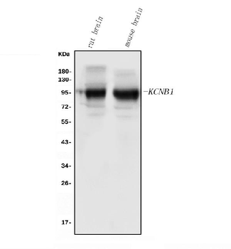 Kv2.1/KCNB1 Rabbit Polyclonal Antibody