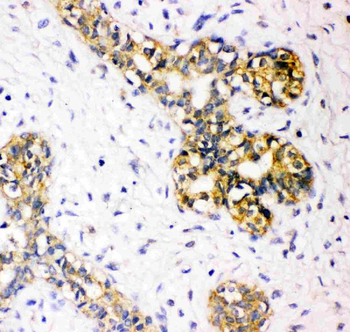 Tuberin/TSC2 Rabbit Polyclonal Antibody