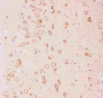 Tuberin/TSC2 Rabbit Polyclonal Antibody