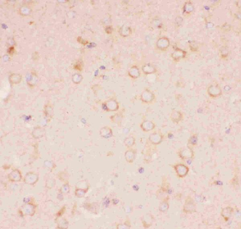 Tuberin/TSC2 Rabbit Polyclonal Antibody