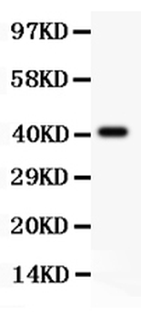 Tuberin/TSC2 Rabbit Polyclonal Antibody