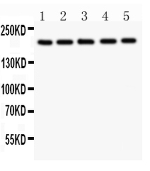 Tuberin/TSC2 Rabbit Polyclonal Antibody