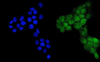 Ubiquitin/UBB Rabbit Polyclonal Antibody
