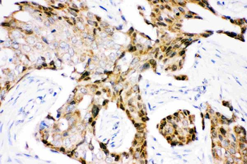 Ubiquitin/UBB Rabbit Polyclonal Antibody